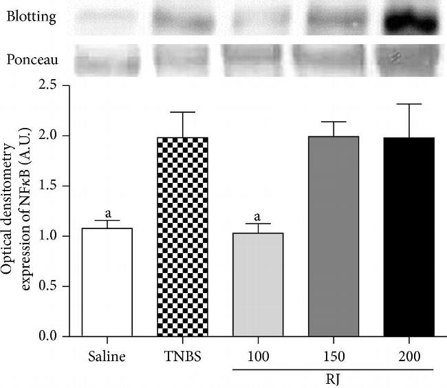 Rabbit IgG (H+L) Secondary Antibody in Western Blot (WB)