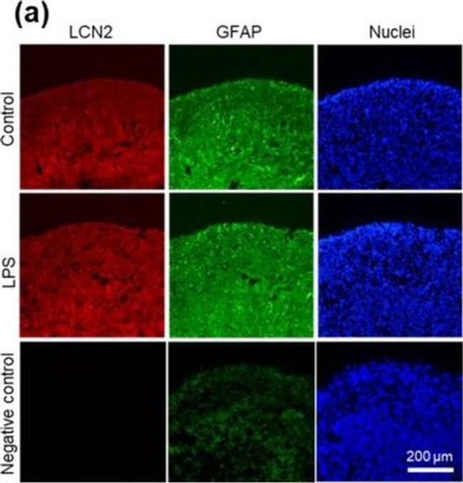 Rabbit IgG (Heavy chain) Secondary Antibody in Immunohistochemistry (PFA fixed) (IHC (PFA))