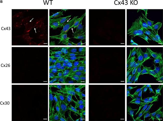 Rabbit IgG (H+L) Highly Cross-Adsorbed Secondary Antibody in Immunocytochemistry (ICC/IF)