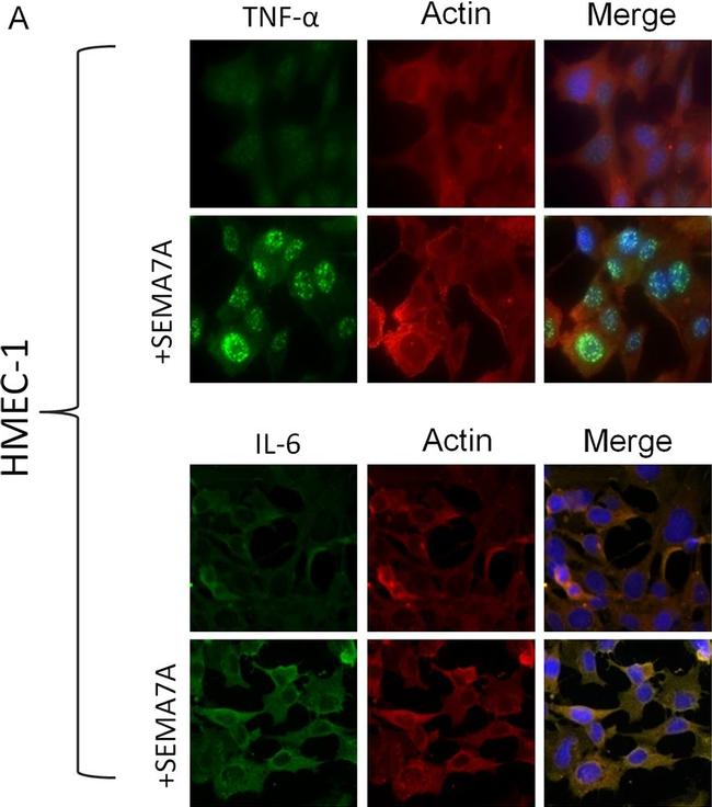 Mouse IgG (H+L) Cross-Adsorbed Secondary Antibody in Immunocytochemistry (ICC/IF)