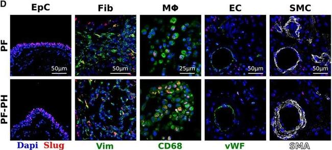 Rabbit IgG (H+L) Cross-Adsorbed Secondary Antibody in Immunohistochemistry (Paraffin) (IHC (P))