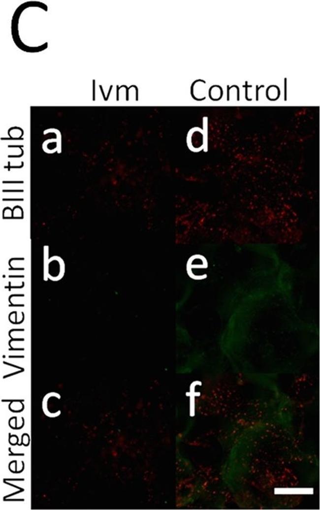 Mouse IgG (H+L) Cross-Adsorbed Secondary Antibody in Immunocytochemistry (ICC/IF)