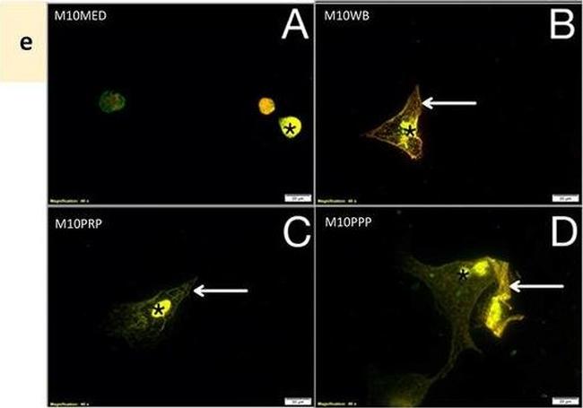 Mouse IgG (H+L) Cross-Adsorbed Secondary Antibody in Immunocytochemistry (ICC/IF)