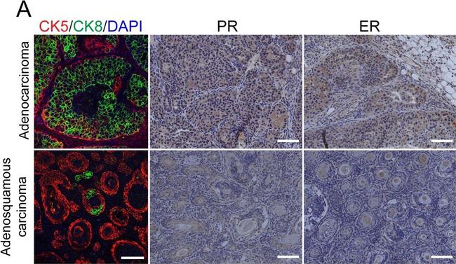 Rabbit IgG (H+L) Highly Cross-Adsorbed Secondary Antibody in Immunohistochemistry (IHC)