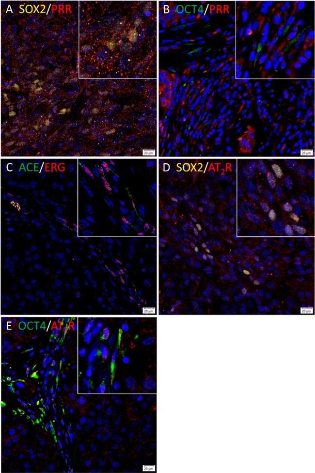 Mouse IgG (H+L) Highly Cross-Adsorbed Secondary Antibody in Immunocytochemistry (ICC/IF)