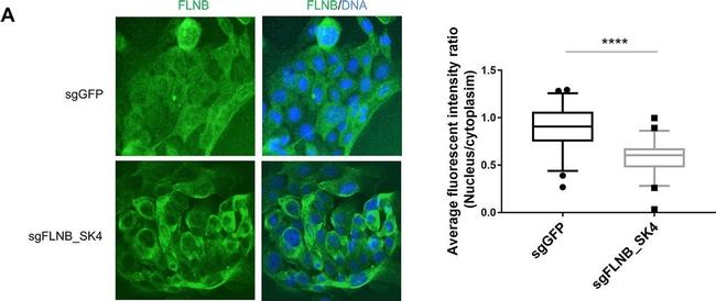 Rabbit IgG (H+L) Secondary Antibody in Immunohistochemistry (IHC)