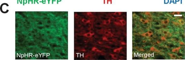 Mouse IgG (H+L) Cross-Adsorbed Secondary Antibody in Immunohistochemistry (IHC)