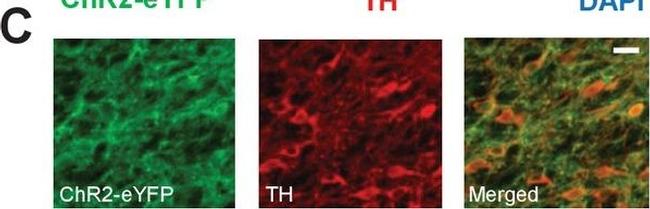 Mouse IgG (H+L) Cross-Adsorbed Secondary Antibody in Immunohistochemistry (IHC)