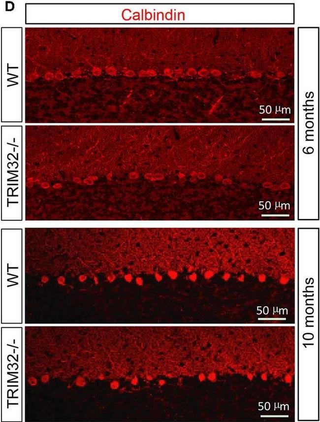 Mouse IgG (H+L) Highly Cross-Adsorbed Secondary Antibody in Immunohistochemistry (IHC)