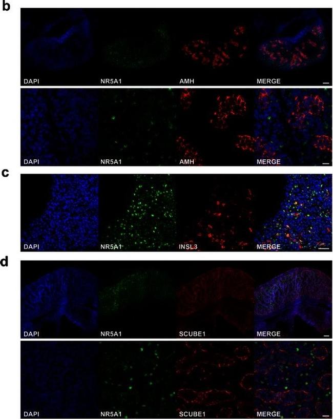 Rabbit IgG (H+L) Highly Cross-Adsorbed Secondary Antibody in Immunohistochemistry (IHC)