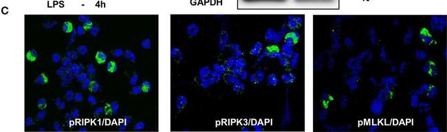 Rabbit IgG (H+L) Cross-Adsorbed Secondary Antibody in Immunocytochemistry (ICC/IF)