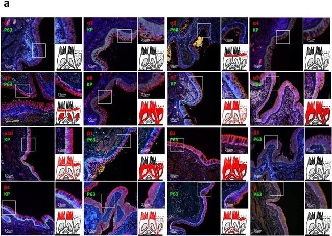 Mouse IgG (H+L) Cross-Adsorbed Secondary Antibody in Immunohistochemistry (Paraffin) (IHC (P))