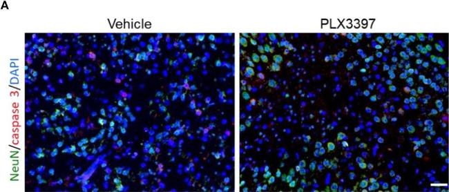 Rabbit IgG (H+L) Cross-Adsorbed Secondary Antibody in Immunohistochemistry (Paraffin) (IHC (P))