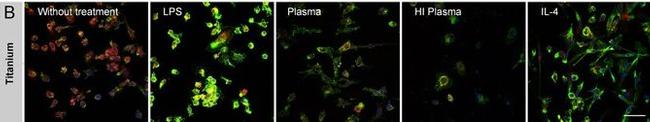 Mouse IgG (H+L) Highly Cross-Adsorbed Secondary Antibody in Immunohistochemistry (Paraffin) (IHC (P))