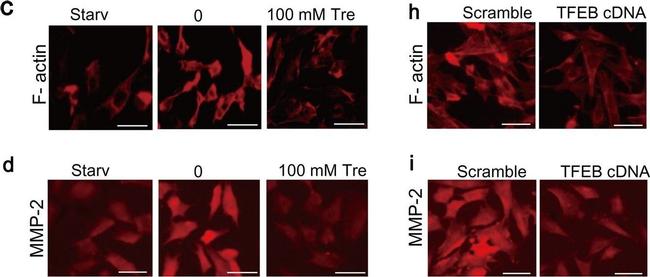 Mouse IgG (H+L) Highly Cross-Adsorbed Secondary Antibody in Immunocytochemistry (ICC/IF)