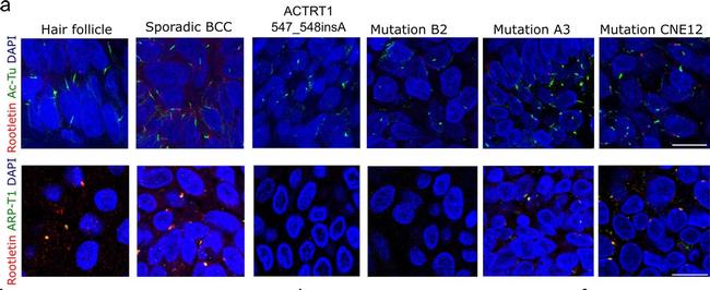 Mouse IgG (H+L) Cross-Adsorbed Secondary Antibody in Immunocytochemistry (ICC/IF)