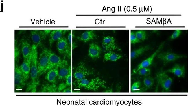 Rabbit IgG (H+L) Secondary Antibody in Immunocytochemistry (ICC/IF)