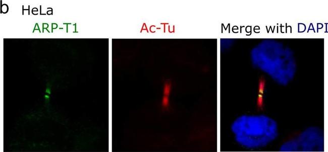 Mouse IgG (H+L) Cross-Adsorbed Secondary Antibody in Immunocytochemistry (ICC/IF)