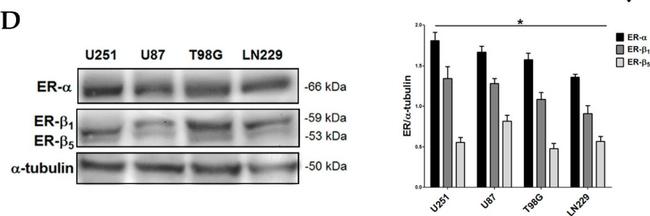 Rabbit IgG (H+L) Secondary Antibody in Western Blot (WB)