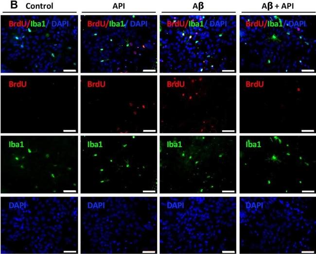 Mouse IgG (H+L) Cross-Adsorbed Secondary Antibody in Immunocytochemistry (ICC/IF)