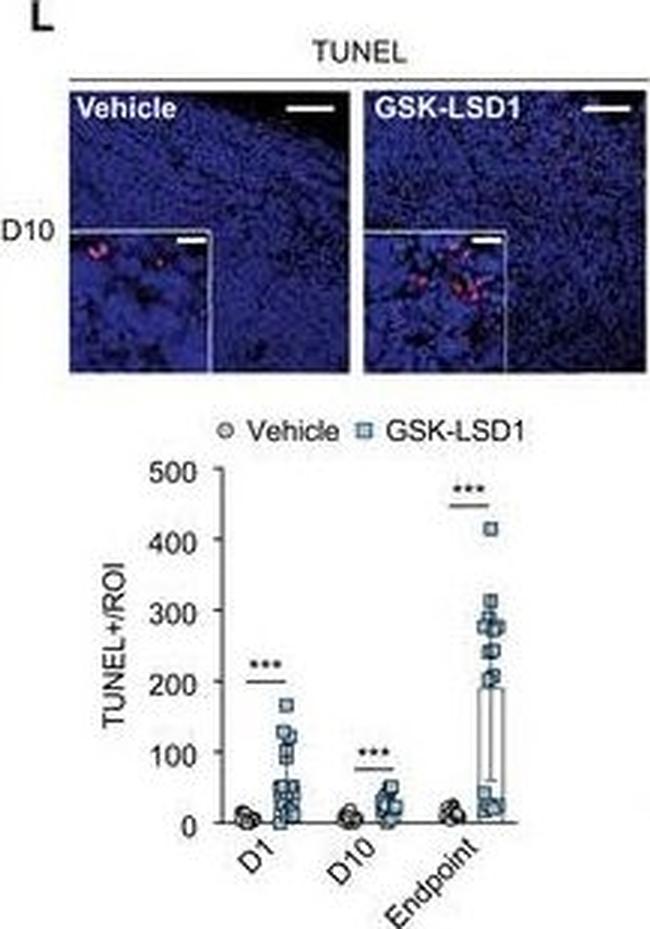 Rabbit IgG (H+L) Cross-Adsorbed Secondary Antibody in Immunohistochemistry (IHC)