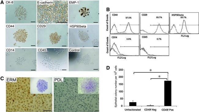 Cytokeratin 8 Antibody in Immunocytochemistry (ICC/IF)