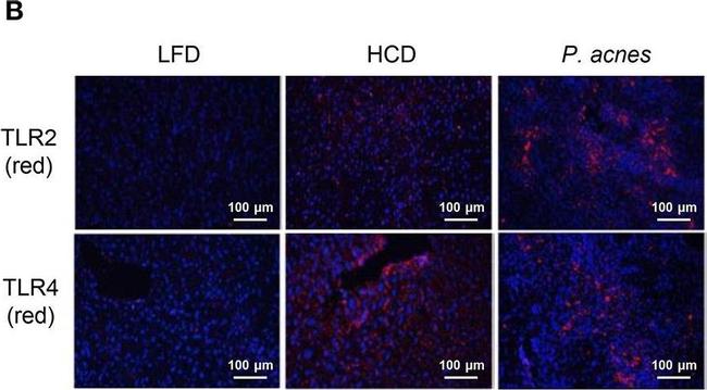 Rat IgG (H+L) Cross-Adsorbed Secondary Antibody in Immunohistochemistry (IHC)