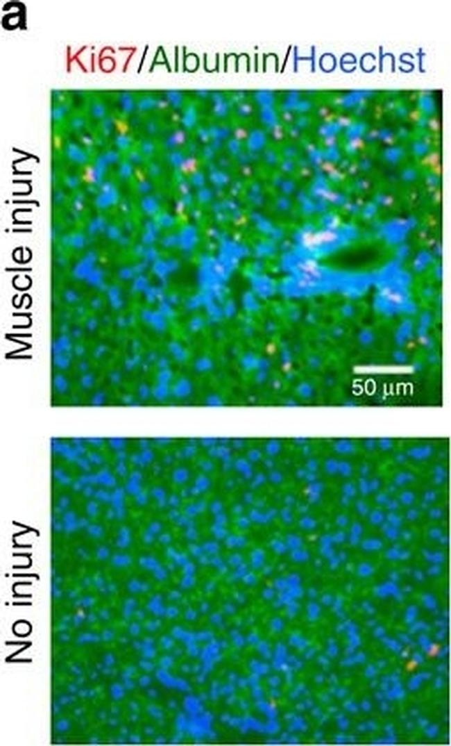 Mouse IgG (H+L) Highly Cross-Adsorbed Secondary Antibody in Immunohistochemistry (Frozen) (IHC (F))