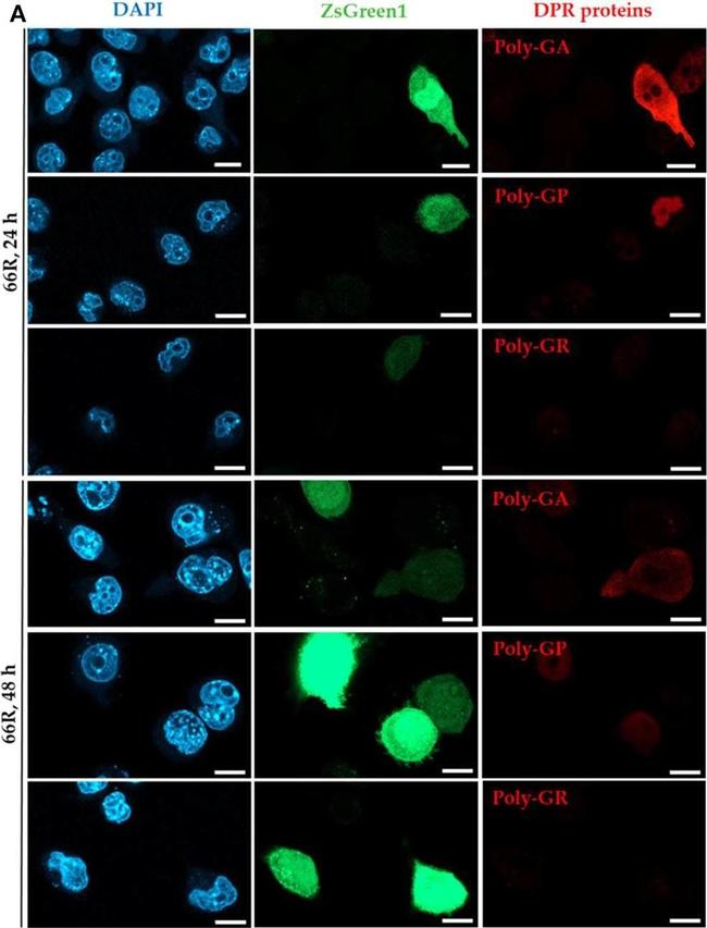 Mouse IgG (H+L) Cross-Adsorbed Secondary Antibody in Immunocytochemistry (ICC/IF)