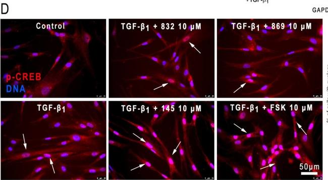 Rabbit IgG (H+L) Cross-Adsorbed Secondary Antibody in Immunocytochemistry (ICC/IF)