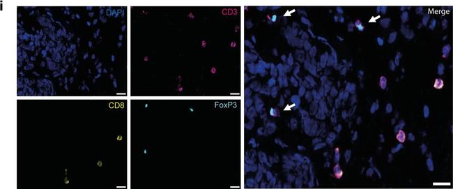 Rat IgG (H+L) Cross-Adsorbed Secondary Antibody in Immunocytochemistry (ICC/IF)