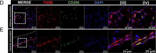 Rat IgG (H+L) Cross-Adsorbed Secondary Antibody in Immunohistochemistry (IHC)