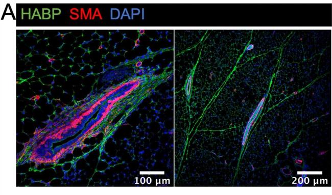 Rabbit IgG (H+L) Cross-Adsorbed Secondary Antibody in Immunohistochemistry (Paraffin) (IHC (P))