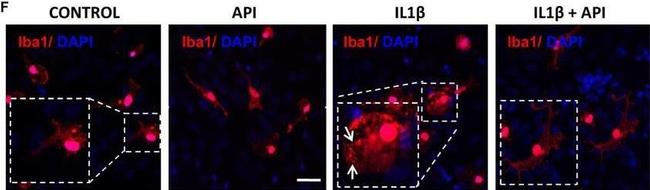 Rabbit IgG (H+L) Cross-Adsorbed Secondary Antibody in Immunocytochemistry (ICC/IF)