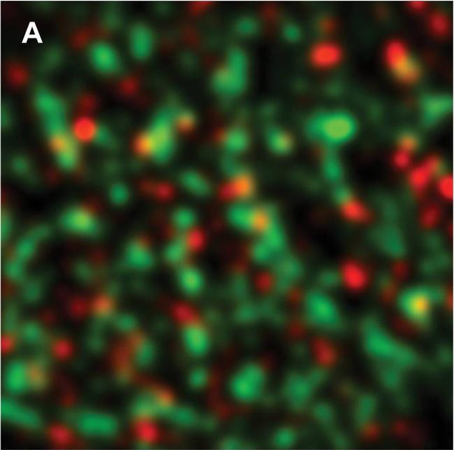 Rabbit IgG (H+L) Cross-Adsorbed Secondary Antibody in Immunocytochemistry (ICC/IF)