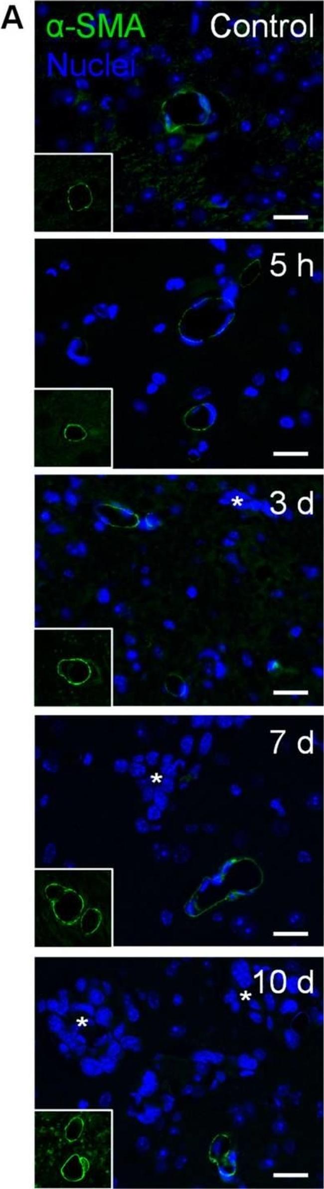 Mouse IgG (H+L) Cross-Adsorbed Secondary Antibody in Immunocytochemistry (ICC/IF)