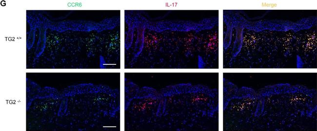 Rat IgG (H+L) Cross-Adsorbed Secondary Antibody in Immunohistochemistry (IHC)