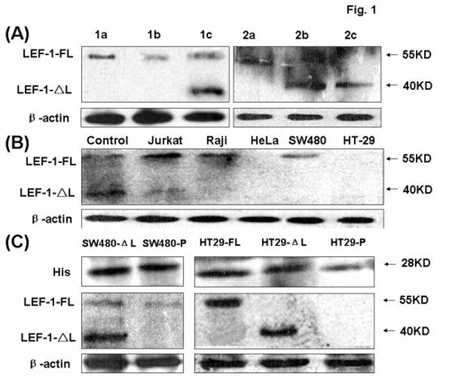 HisG Epitope Tag Antibody in Western Blot (WB)