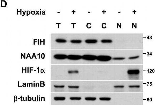 Mouse IgG (H+L) Cross-Adsorbed Secondary Antibody in Immunohistochemistry (IHC)