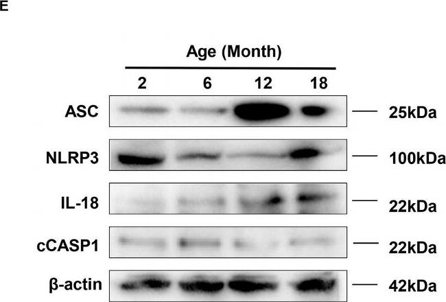 Rabbit IgG (H+L) Secondary Antibody in Western Blot (WB)