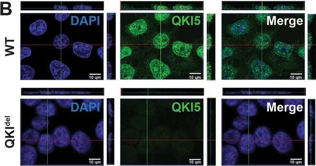 Rabbit IgG (H+L) Cross-Adsorbed Secondary Antibody in Immunocytochemistry (ICC/IF)