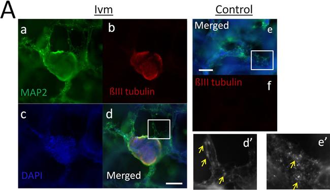 Mouse IgG (H+L) Cross-Adsorbed Secondary Antibody in Immunocytochemistry (ICC/IF)