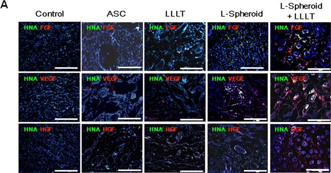 Rabbit IgG (H+L) Cross-Adsorbed Secondary Antibody in Immunocytochemistry (ICC/IF)