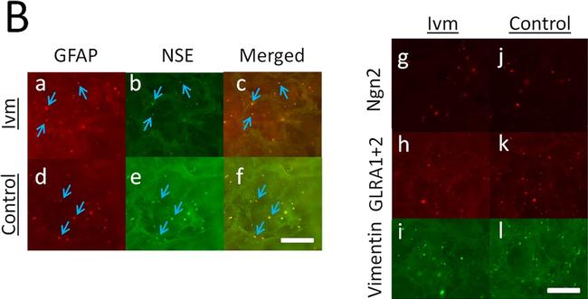 Mouse IgG (H+L) Cross-Adsorbed Secondary Antibody in Immunocytochemistry (ICC/IF)