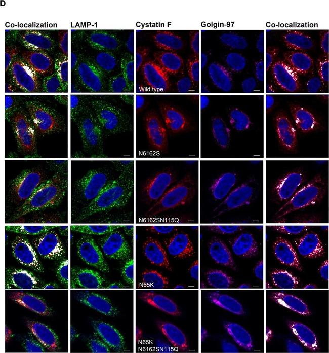 Mouse IgG (H+L) Highly Cross-Adsorbed Secondary Antibody in Immunocytochemistry (ICC/IF)