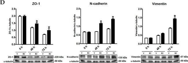 Rabbit IgG (H+L) Secondary Antibody in Western Blot (WB)