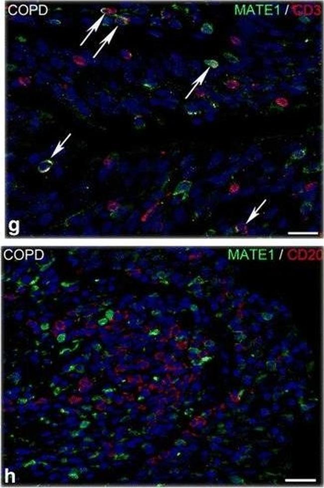 Mouse IgG (H+L) Cross-Adsorbed Secondary Antibody in Immunohistochemistry (IHC)