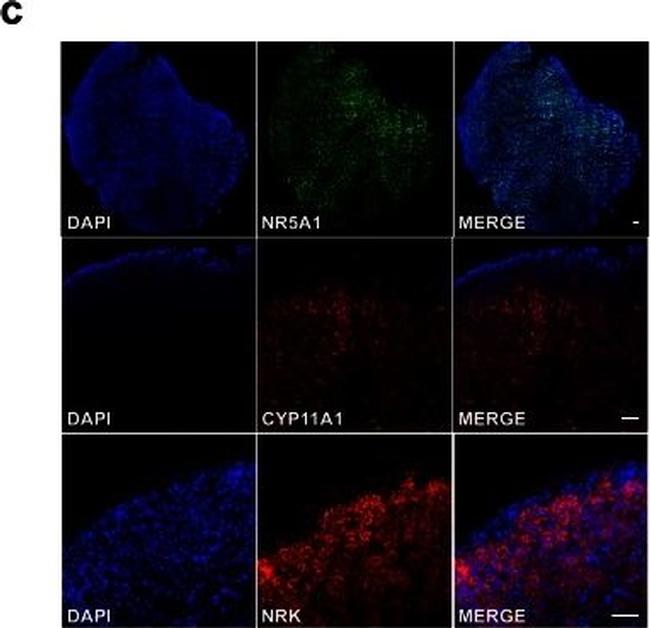 Rabbit IgG (H+L) Highly Cross-Adsorbed Secondary Antibody in Immunohistochemistry (IHC)