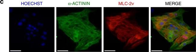 Rabbit IgG (H+L) Cross-Adsorbed Secondary Antibody in Immunocytochemistry (ICC/IF)