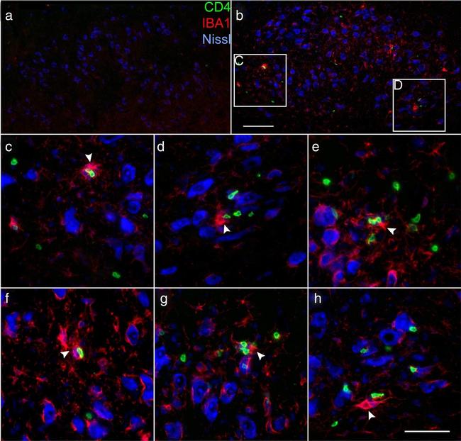 Rat IgG (H+L) Highly Cross-Adsorbed Secondary Antibody in Immunohistochemistry (IHC)